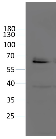 Western blot using anti-PARP2 antibodies